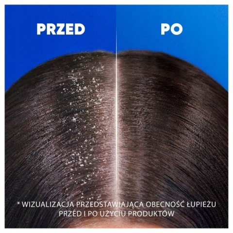 HEAD&SHOULDERS Szampon do włosów 400ml Citrus Fresh